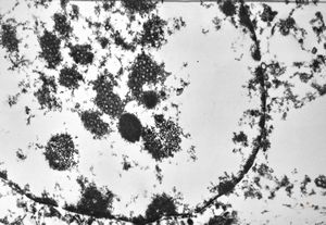M,11d. | herpes virus, adrenal M,11d. | herpes virus, adrenal